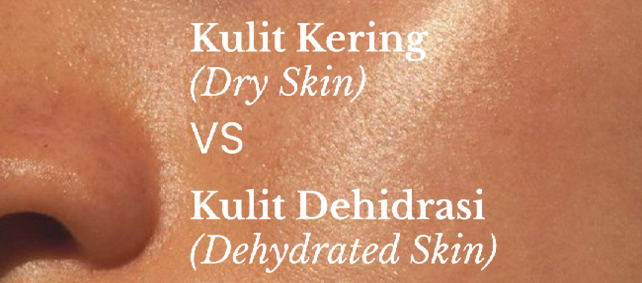 Kulit Kepala Kering Vs Kulit Kepala Berminyak – Penjagaan Berbeza?